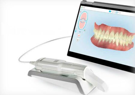 Benefits of 3D Dental Scanners: Faster, More Accurate Treatment Planning