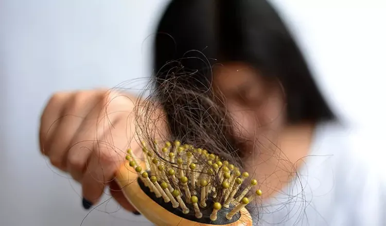 How to Prevent Hair Fall Naturally with Homeopathy